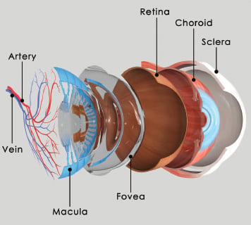 macula degeneration