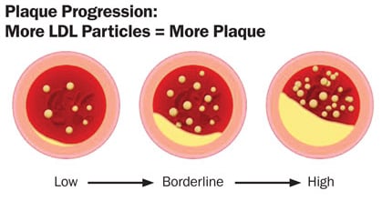 what's the difference between LDL-P and LDL-C